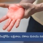 గులియన్ బారే సిండ్రోమ్: లక్షణాలు, రకాలు మరియు నివారణ పద్ధతులు!
