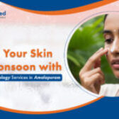 Protect Your Skin This Monsoon with the Best Dermatology Services in Amalapuram